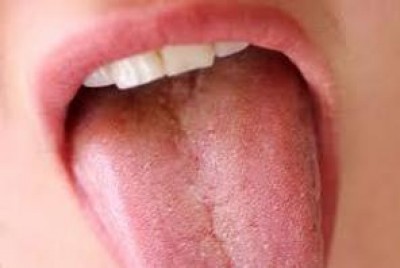 Cavo orale,diagnosi e terapia