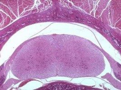 EHI, TU! Hai midollo?