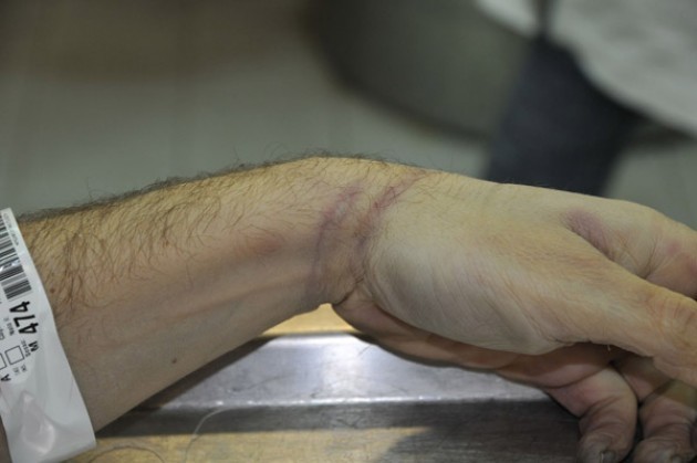 Firenze Caso Magherini Amnesty scrive al Ministro Alfano