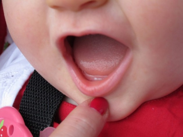 Bambini e dentizione. Pericoloso l'uso di derivati della benzocaina