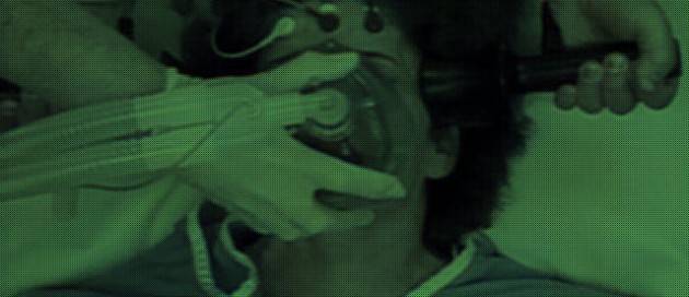 La TEC causa ETC? Meglio un pugno da Mike Tyson o un elettroshock?