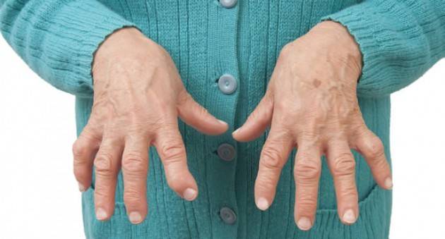 Firma la petizione per il Vaccino che cura l’Artrite Reumatoide