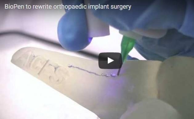 Tecno Nel 2017  messa sul mercato la Penna 3D che permette di curare le ossa