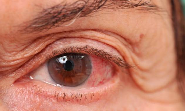 UICI Cremona Giornata della prevenzione del Glaucoma il 16 marzo