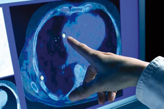 LNews-CURE ONCOLOGICHE,REGIONE SOSTIENE 'PROGETTO PARRUCCHE' PER DONNE SOTTOPOSTE A TERAPIE: MISURA FINANZIATA CON 400.000 EURO