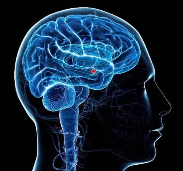 DENTRO I NEURONI IMPAZZITI CHE SCATENANO I TUMORI AL CERVELLO