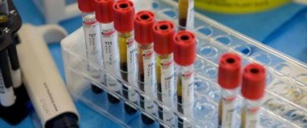 Sui test sierologici ci atteniamo alla scienza