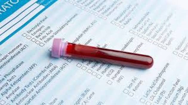 Gallera: ''Dalla prossima settimana test per gli anticorpi''