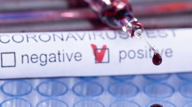 Al via i test sierologici in 14 centri in Lombardia