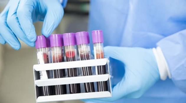 In Lombardia potenzialità di fare 10mila test sierologici al giorno