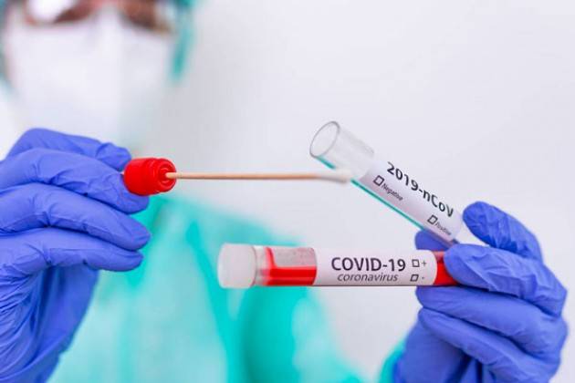 Covid-19 Da lunedì 25 in corso i test sieroprevalenza. I comuni della provincia di Cremona interessati sono 13