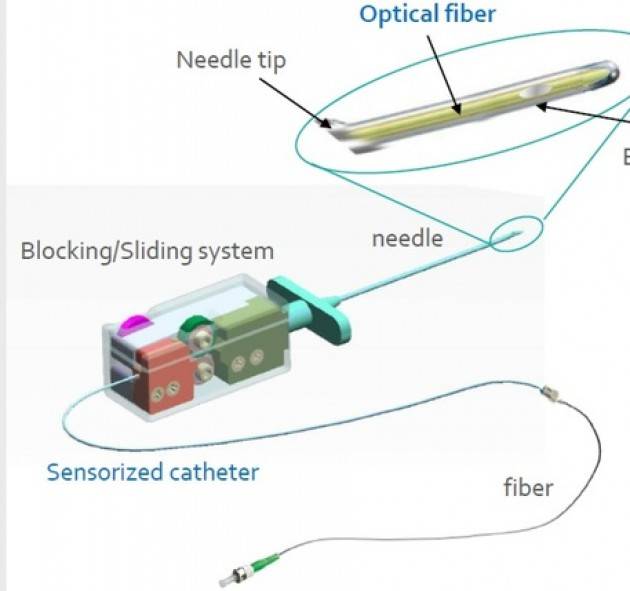 Fibra ottica per anestesia epidurale