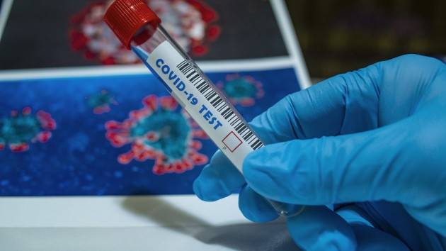 ??? Il coronavirus resiste 28 giorni sulle superfici?