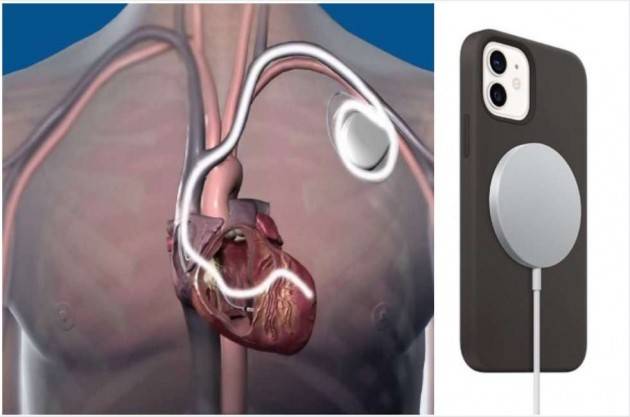 Zeus iPhone 12 e pacemaker, meglio che stiano lontani
