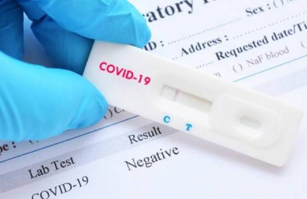 Italia Covid Il Kit tampone fai da te disponibile in farmacia e supermercati