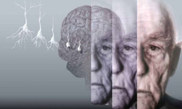 ALZHEIMER: PRESERVARE LA MEMORIA CON LA STIMOLAZIONE MAGNETICA