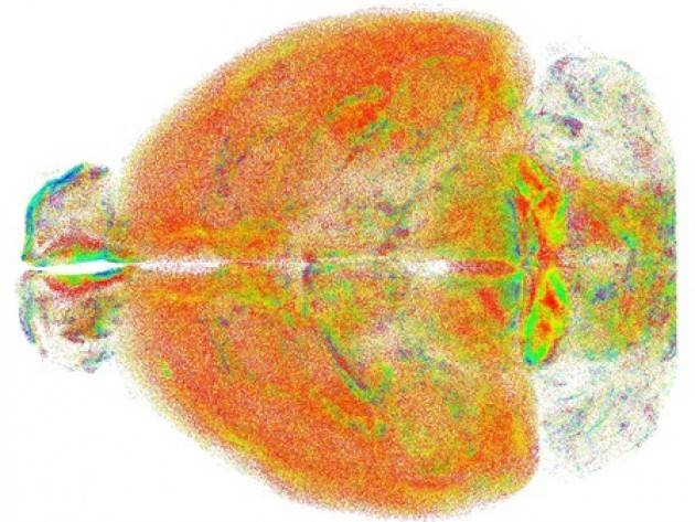 Studio del cervello, la ricerca si mette... a fuoco