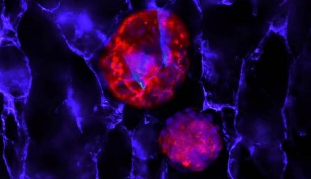 L’idrogel che supporta la crescita di cellule tumorali a lungo termine
