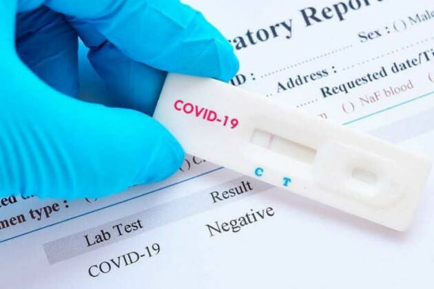 Quali sono i test per individuare il Covid-19?