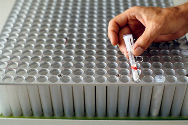 Una variante più virulenta dell’HIV rilevata in Olanda