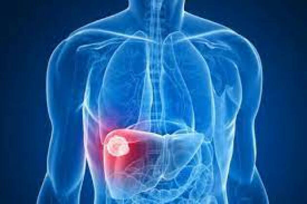 ATS VAL PADANA GUARIRE DALL’EPATITE C:PER TUTTI I NATI TRA IL 1969 E IL 1989