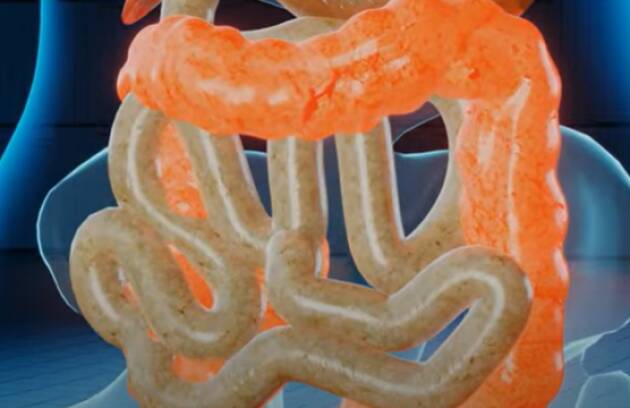 ADUC Gli effetti della tecnologia estrema. Le microplastiche nel sangue