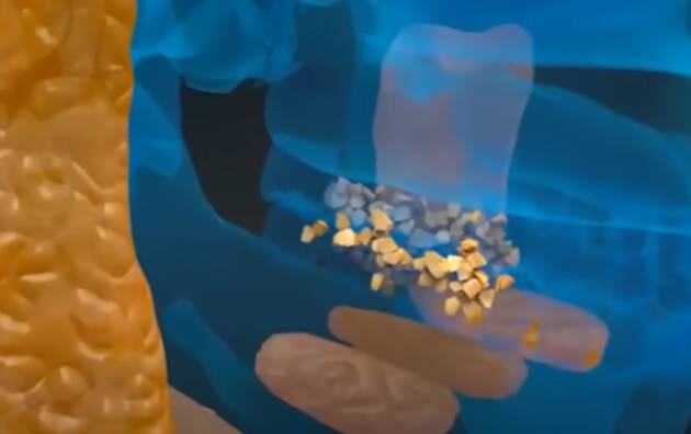 ADUC Tuome al pancreas. Test e vaccino per sconfiggerlo