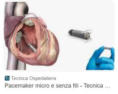 ASST Cremona Cardiologia Cremona PRIMO IMPIANTO DI PACEMAKER ATRIALE SENZA FILI