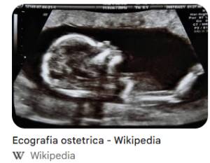 ASST CREMA Ecografia delle anche ai neonati