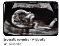 ASST CREMA Ecografia delle anche ai neonati