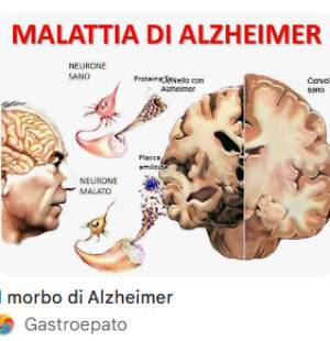 ADUC Roma Morbo di Alzheimer: chi paga la retta della RSA?