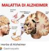 ADUC Roma Morbo di Alzheimer: chi paga la retta della RSA?